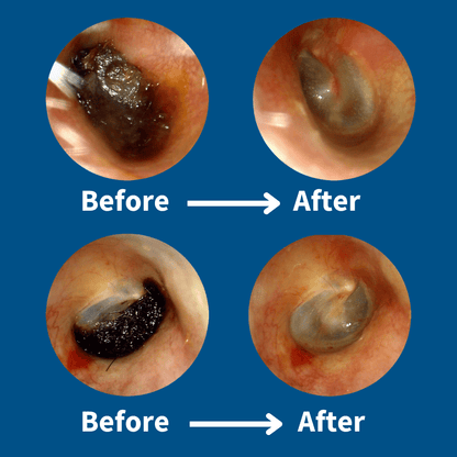 ClearCam Ear Cleaner